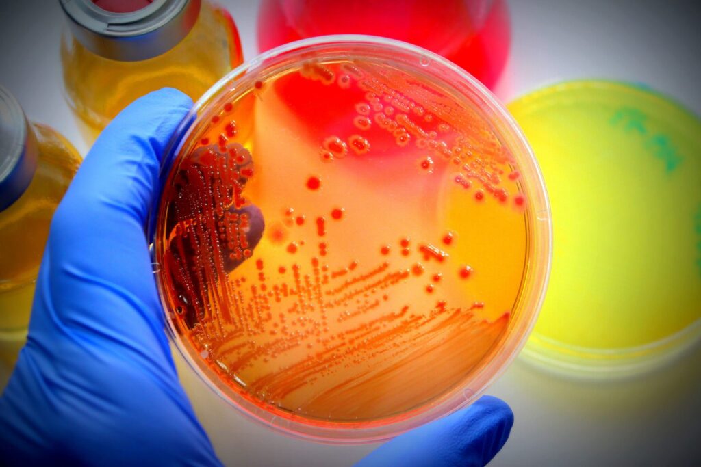 شرح دروس رشته زیست شناسی میکروبی - میکروبیولوژی